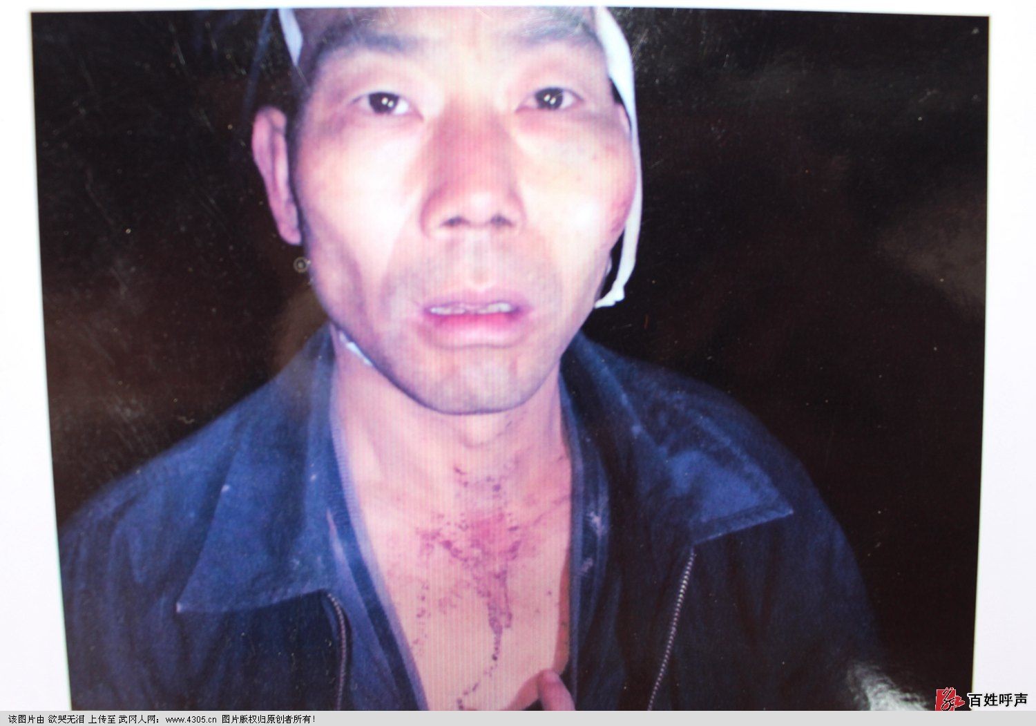 马坪乡干部殴打百姓，受害者反遭拘留
